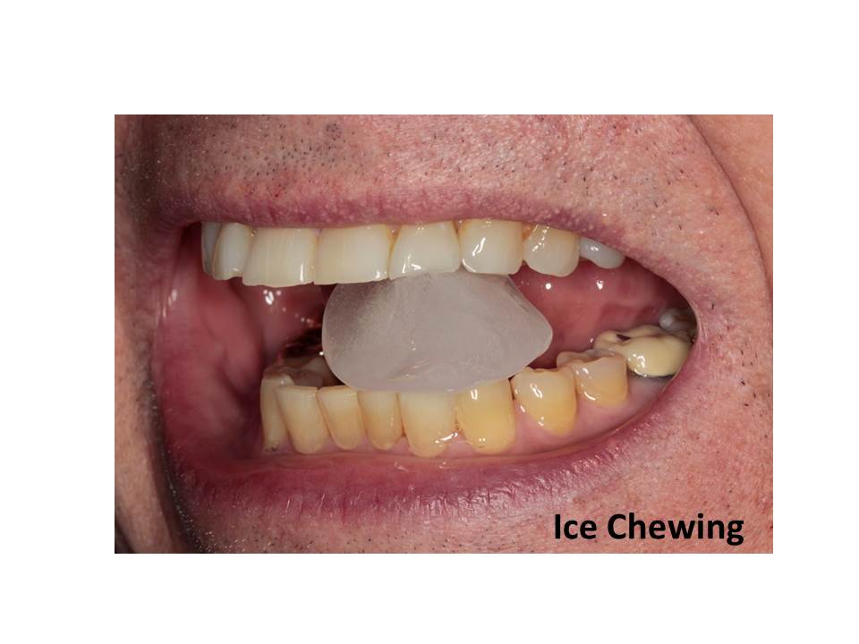 Ice Chewing Delmarva Dental Services 